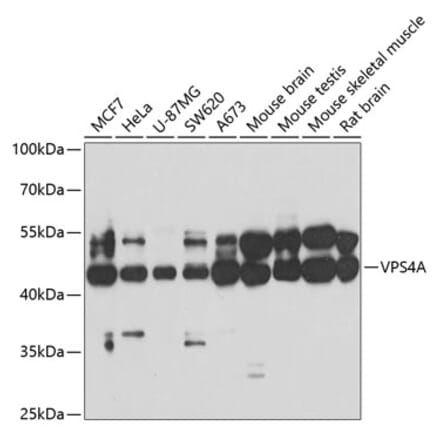 Western Blot - Anti-VPS4a Antibody (A15539) - Antibodies.com