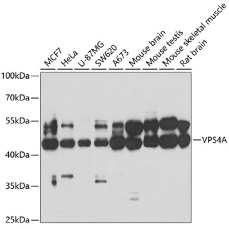 Western Blot - Anti-VPS4a Antibody (A15539) - Antibodies.com