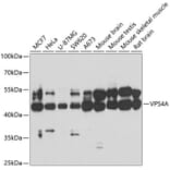 Western Blot - Anti-VPS4a Antibody (A15539) - Antibodies.com