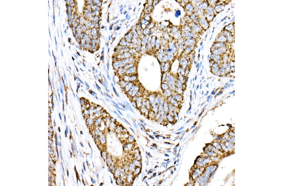 Immunohistochemistry - Anti-VPS4a Antibody (A15539) - Antibodies.com