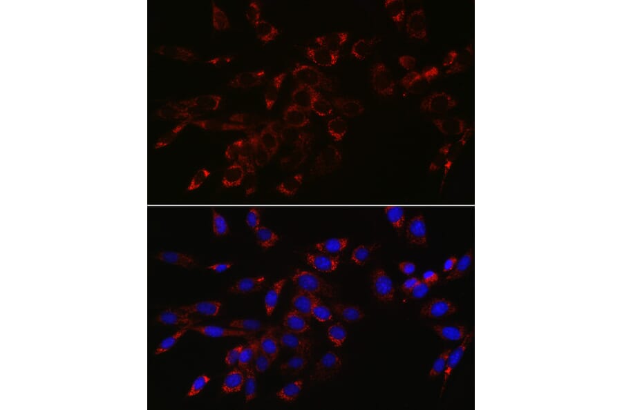 Immunofluorescence - Anti-VPS4a Antibody (A15539) - Antibodies.com