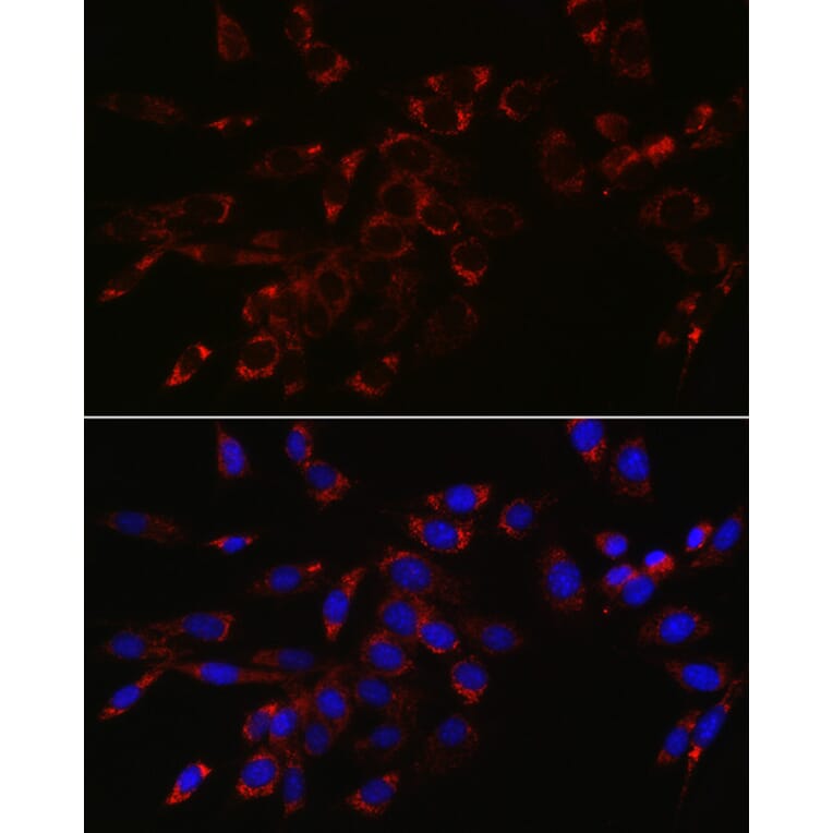 Immunofluorescence - Anti-VPS4a Antibody (A15539) - Antibodies.com