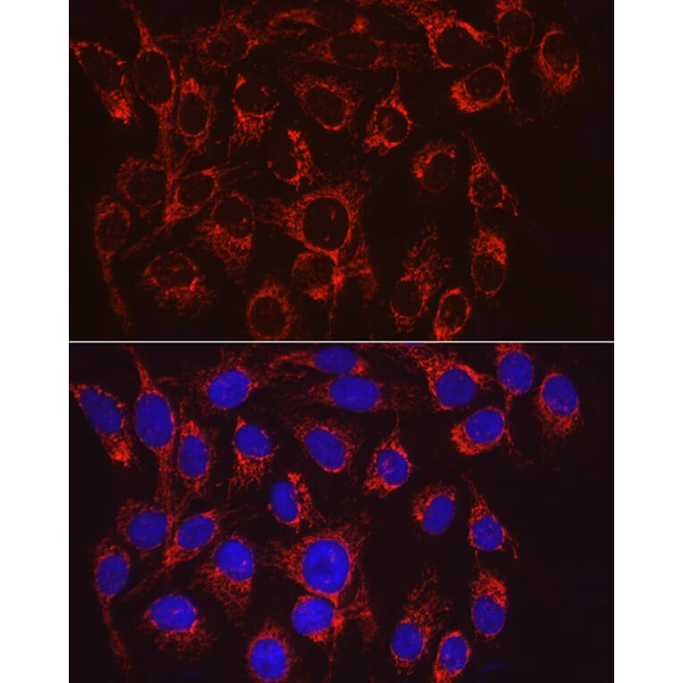 Immunofluorescence - Anti-VPS4a Antibody (A15539) - Antibodies.com
