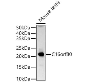 Western Blot - Anti-GTL3 Antibody (A15541) - Antibodies.com