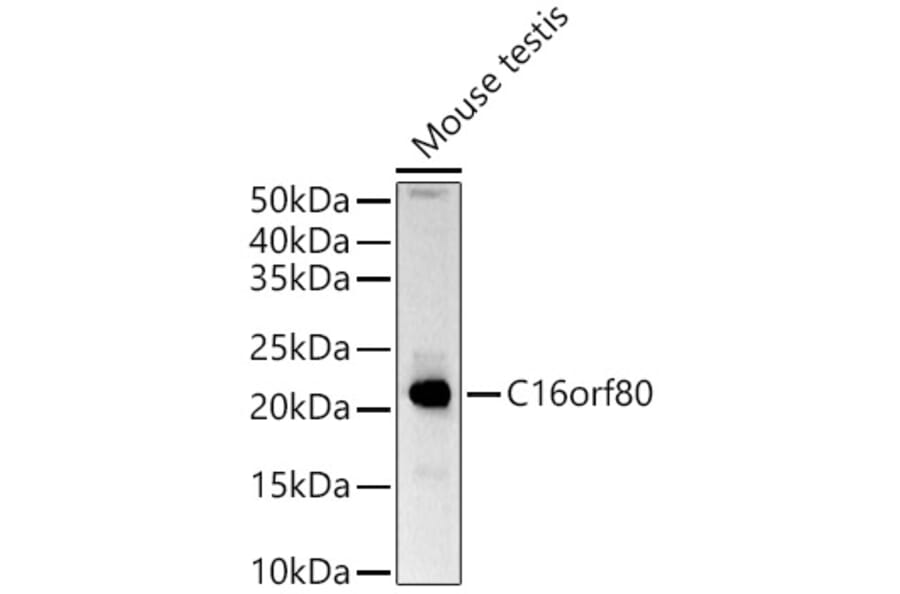 Western Blot - Anti-GTL3 Antibody (A15541) - Antibodies.com