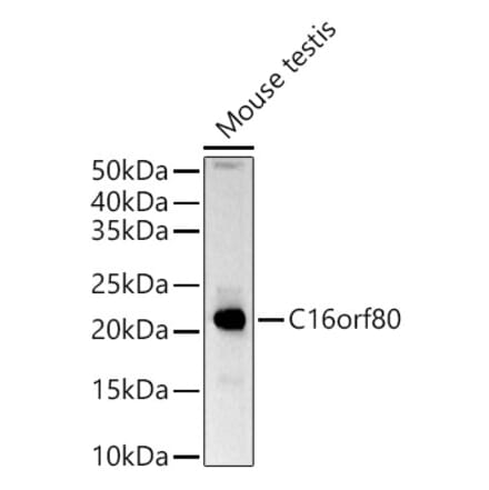Western Blot - Anti-GTL3 Antibody (A15541) - Antibodies.com