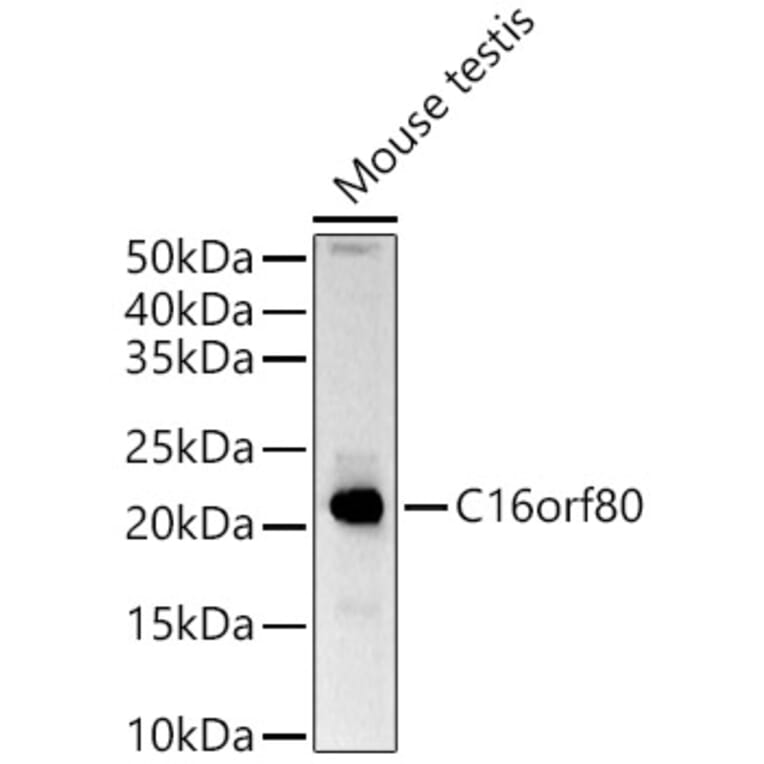 Western Blot - Anti-GTL3 Antibody (A15541) - Antibodies.com