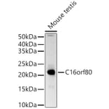 Western Blot - Anti-GTL3 Antibody (A15541) - Antibodies.com