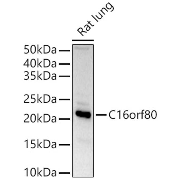 Western Blot - Anti-GTL3 Antibody (A15541) - Antibodies.com