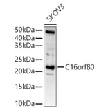 Western Blot - Anti-GTL3 Antibody (A15541) - Antibodies.com