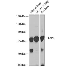 Western Blot - Anti-LAP3 Antibody (A15542) - Antibodies.com