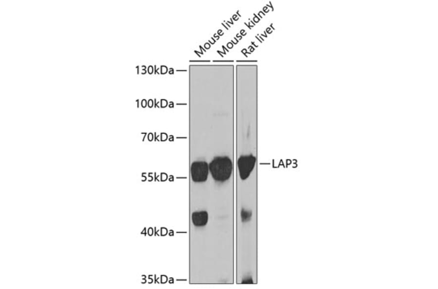 Western Blot - Anti-LAP3 Antibody (A15542) - Antibodies.com