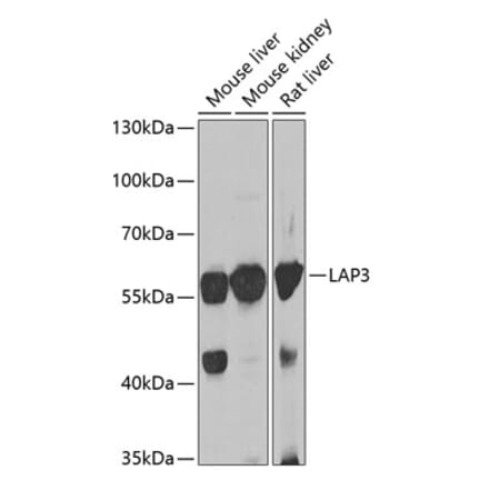 Western Blot - Anti-LAP3 Antibody (A15542) - Antibodies.com