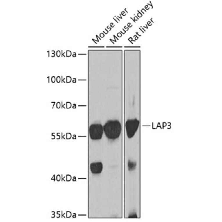 Western Blot - Anti-LAP3 Antibody (A15542) - Antibodies.com