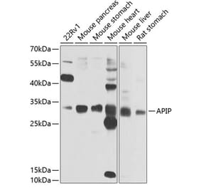 Western Blot - Anti-APIP Antibody (A15543) - Antibodies.com