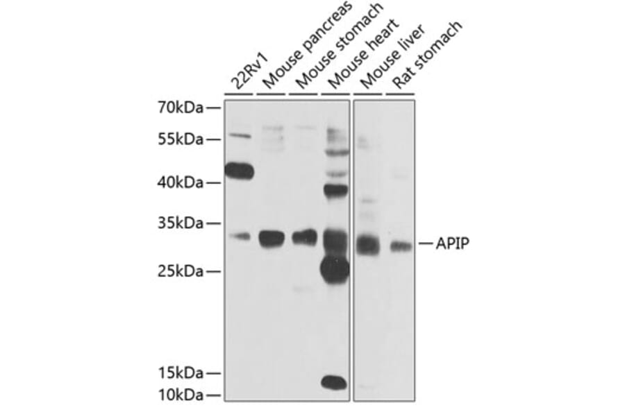 Western Blot - Anti-APIP Antibody (A15543) - Antibodies.com