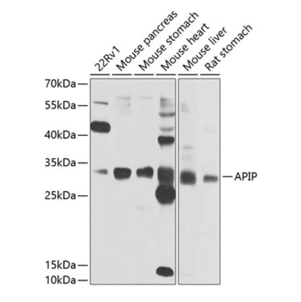 Western Blot - Anti-APIP Antibody (A15543) - Antibodies.com