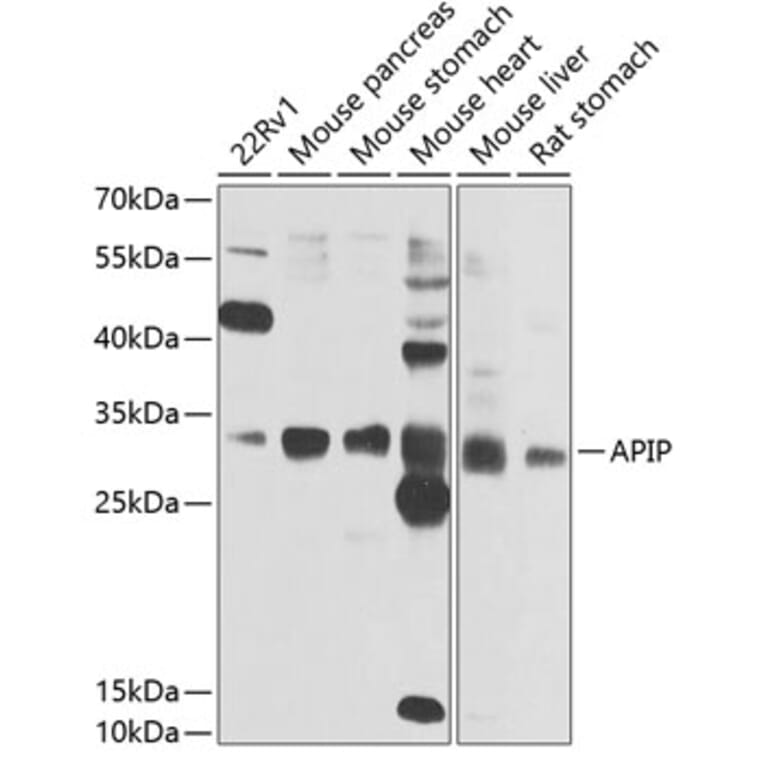 Western Blot - Anti-APIP Antibody (A15543) - Antibodies.com