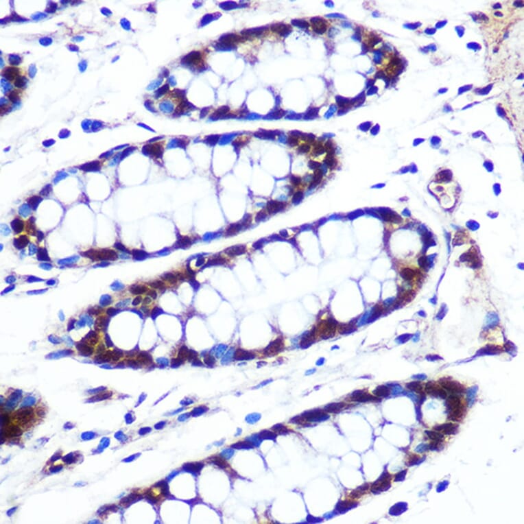 Immunohistochemistry - Anti-APIP Antibody (A15543) - Antibodies.com