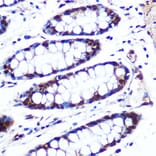 Immunohistochemistry - Anti-APIP Antibody (A15543) - Antibodies.com
