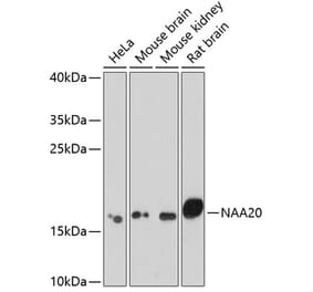Western Blot - Anti-NAA20 Antibody (A15545) - Antibodies.com