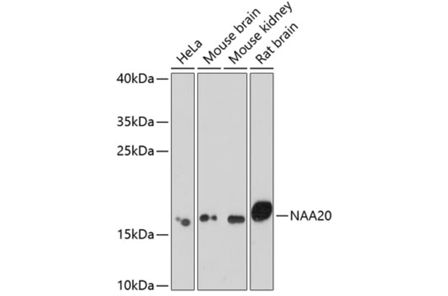 Western Blot - Anti-NAA20 Antibody (A15545) - Antibodies.com