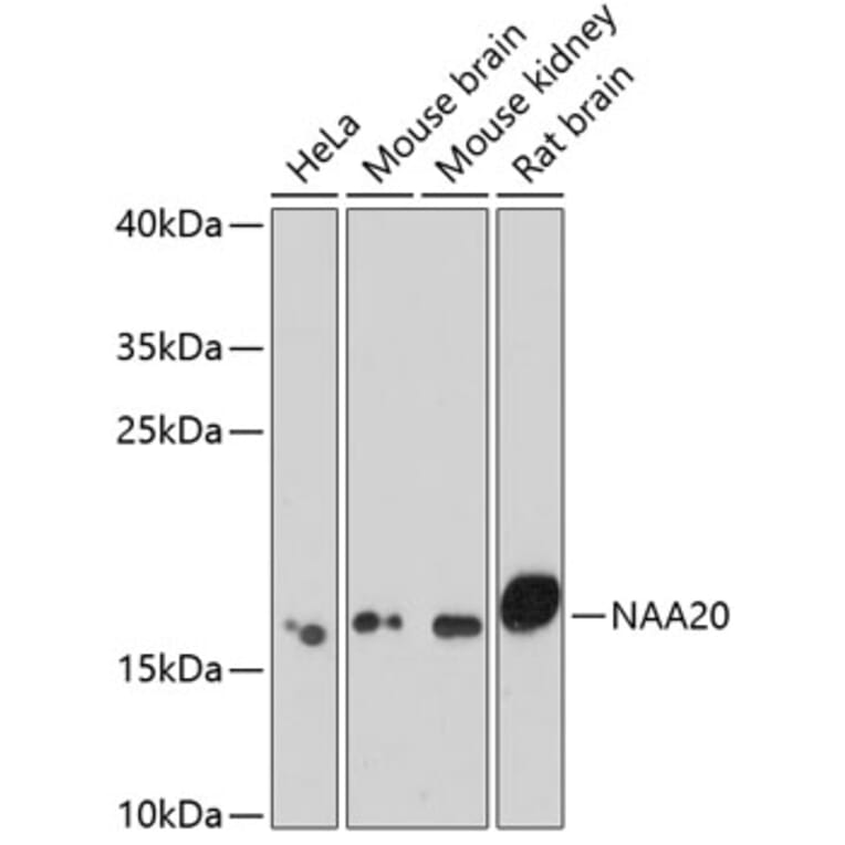 Western Blot - Anti-NAA20 Antibody (A15545) - Antibodies.com