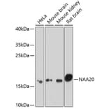 Western Blot - Anti-NAA20 Antibody (A15545) - Antibodies.com