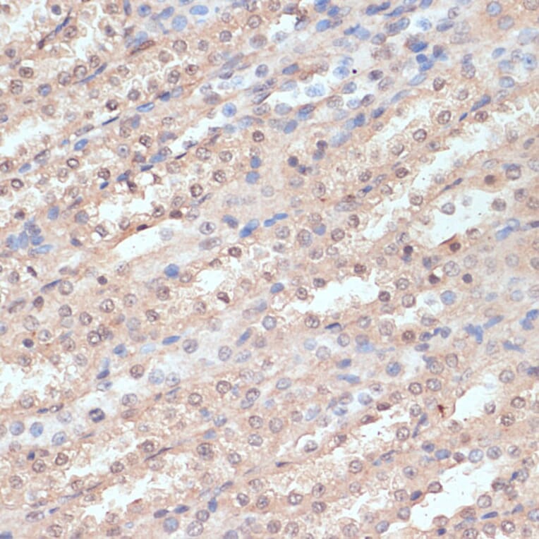 Immunohistochemistry - Anti-NAA20 Antibody (A15545) - Antibodies.com