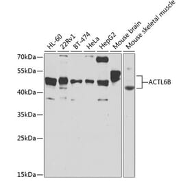 Western Blot - Anti-BAF53b Antibody (A15546) - Antibodies.com