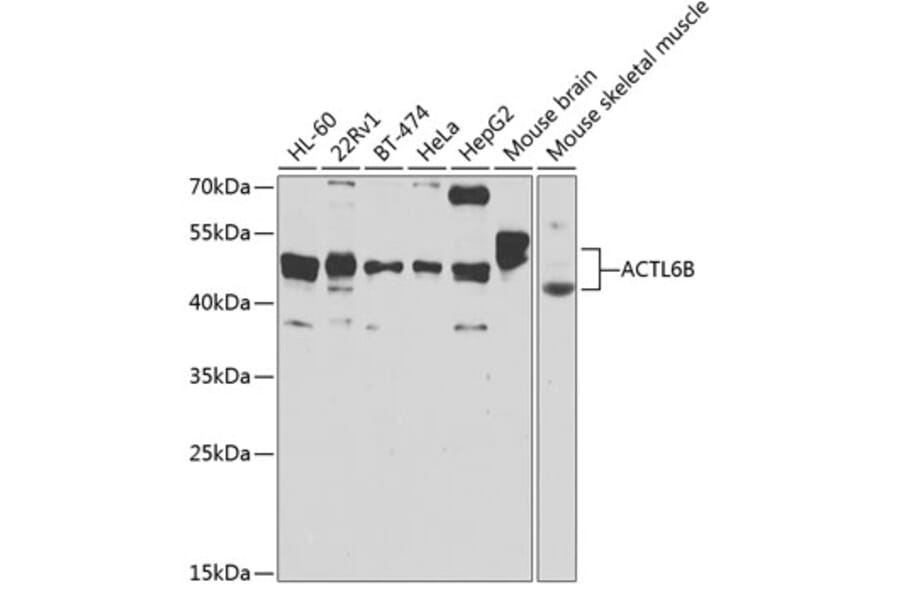 Western Blot - Anti-BAF53b Antibody (A15546) - Antibodies.com