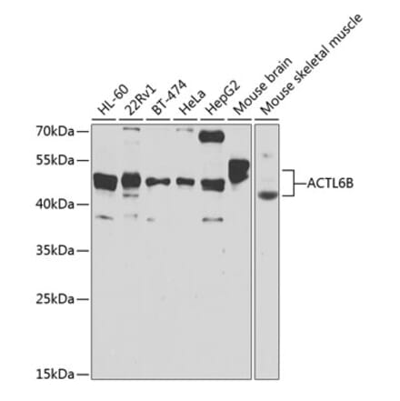 Western Blot - Anti-BAF53b Antibody (A15546) - Antibodies.com