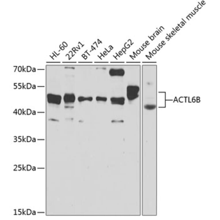 Western Blot - Anti-BAF53b Antibody (A15546) - Antibodies.com