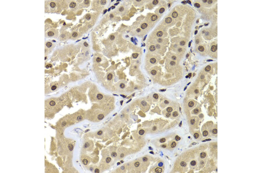 Immunohistochemistry - Anti-BAF53b Antibody (A15546) - Antibodies.com