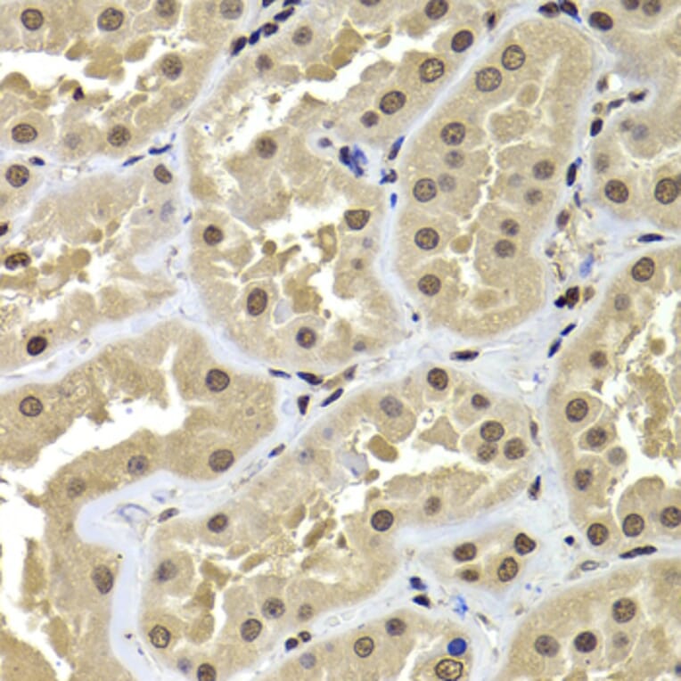 Immunohistochemistry - Anti-BAF53b Antibody (A15546) - Antibodies.com
