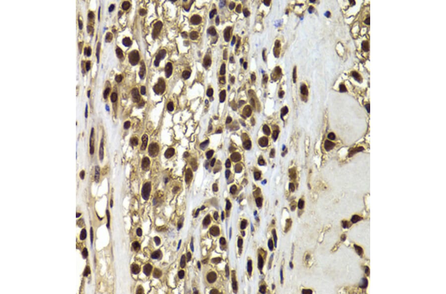 Immunohistochemistry - Anti-BAF53b Antibody (A15546) - Antibodies.com