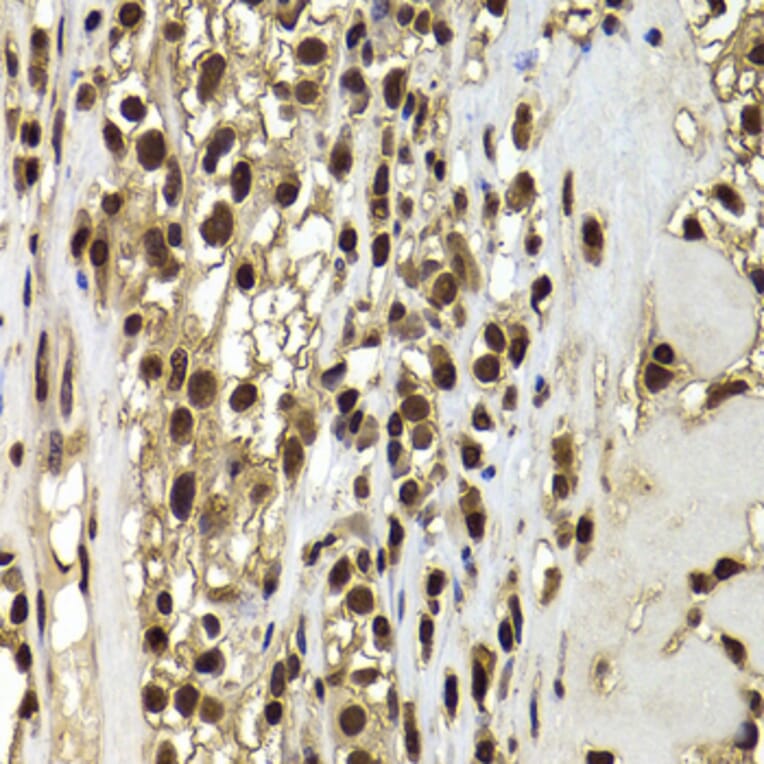 Immunohistochemistry - Anti-BAF53b Antibody (A15546) - Antibodies.com