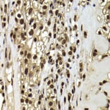 Immunohistochemistry - Anti-BAF53b Antibody (A15546) - Antibodies.com