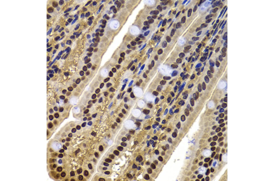 Immunohistochemistry - Anti-BAF53b Antibody (A15546) - Antibodies.com