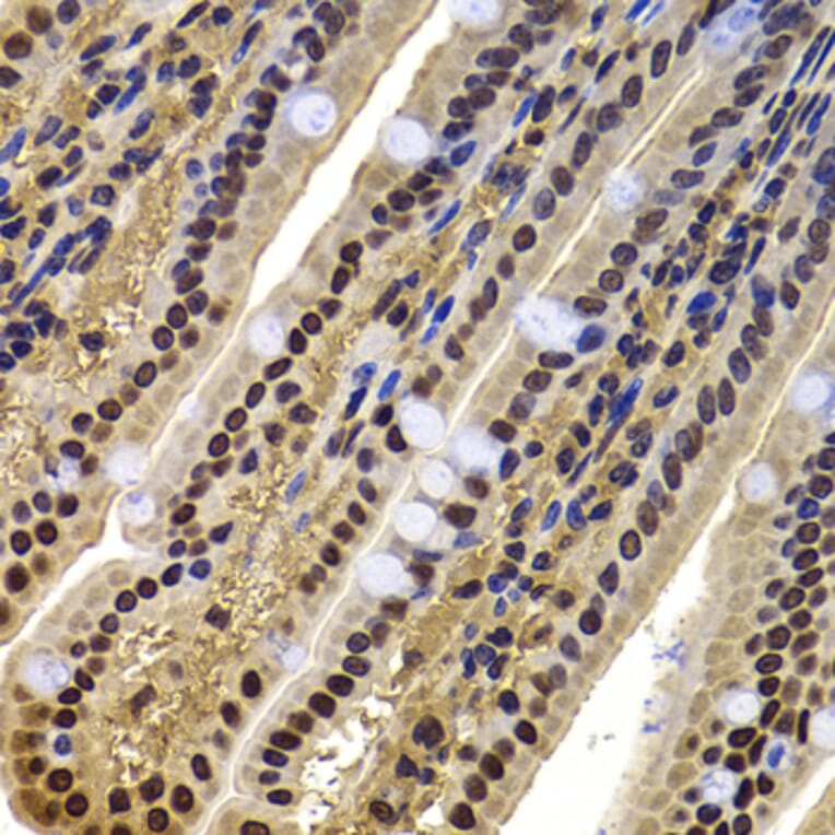 Immunohistochemistry - Anti-BAF53b Antibody (A15546) - Antibodies.com