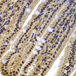 Immunohistochemistry - Anti-BAF53b Antibody (A15546) - Antibodies.com