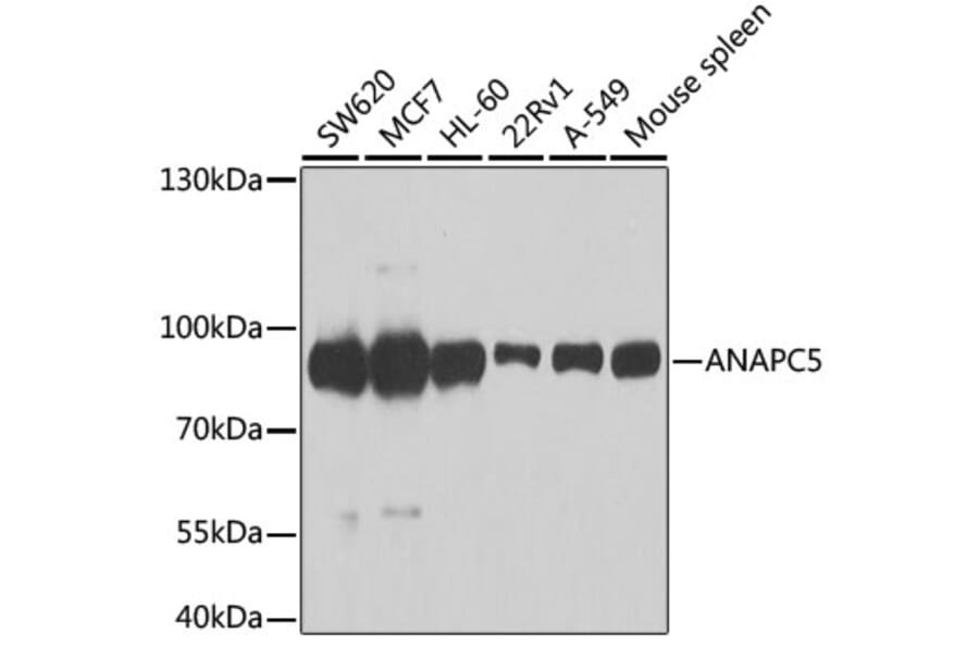 Western Blot - Anti-Apc5 Antibody (A15547) - Antibodies.com