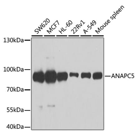 Western Blot - Anti-Apc5 Antibody (A15547) - Antibodies.com