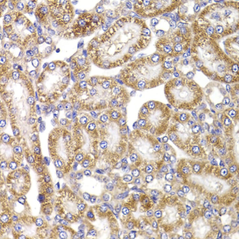 Immunohistochemistry - Anti-Apc5 Antibody (A15547) - Antibodies.com