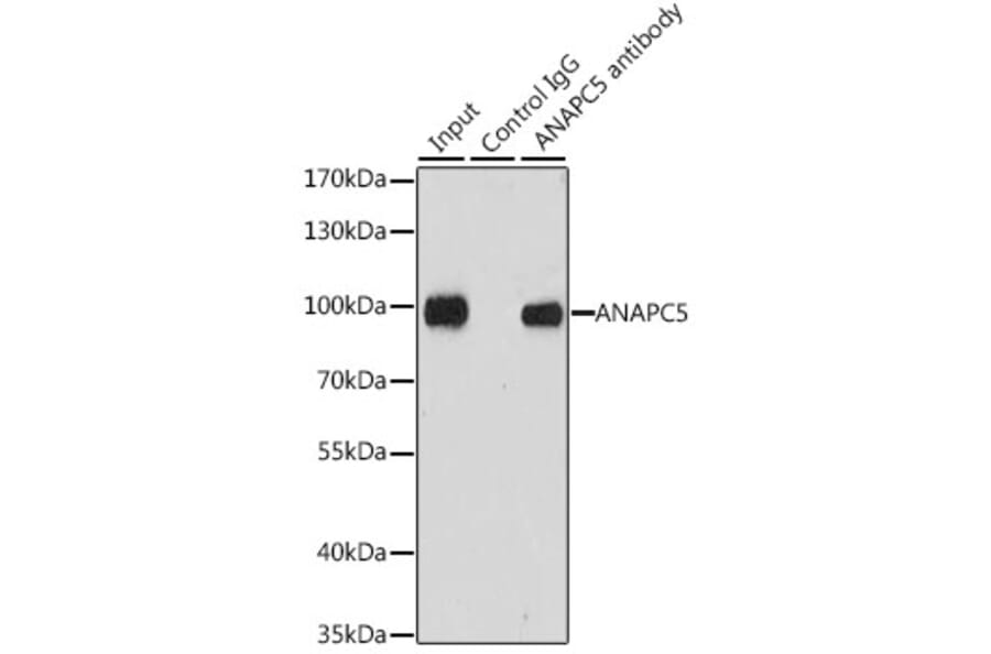 Western Blot - Anti-Apc5 Antibody (A15547) - Antibodies.com