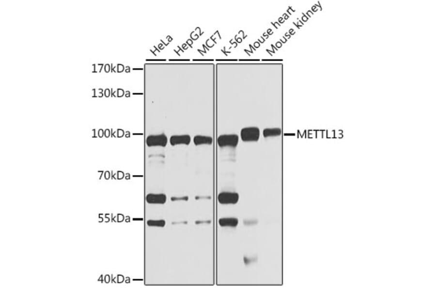 Western Blot - Anti-METTL13 Antibody (A15548) - Antibodies.com