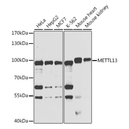 Western Blot - Anti-METTL13 Antibody (A15548) - Antibodies.com