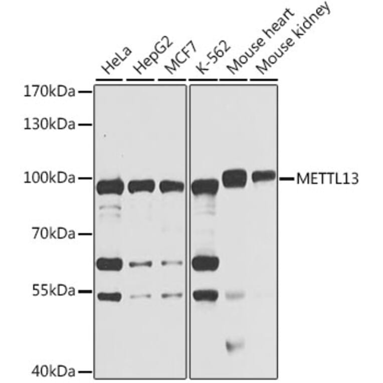 Western Blot - Anti-METTL13 Antibody (A15548) - Antibodies.com
