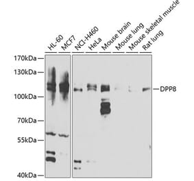 Western Blot - Anti-DPP8 Antibody (A15549) - Antibodies.com