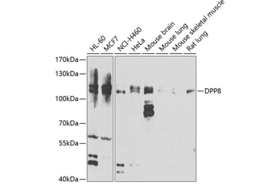 Western Blot - Anti-DPP8 Antibody (A15549) - Antibodies.com